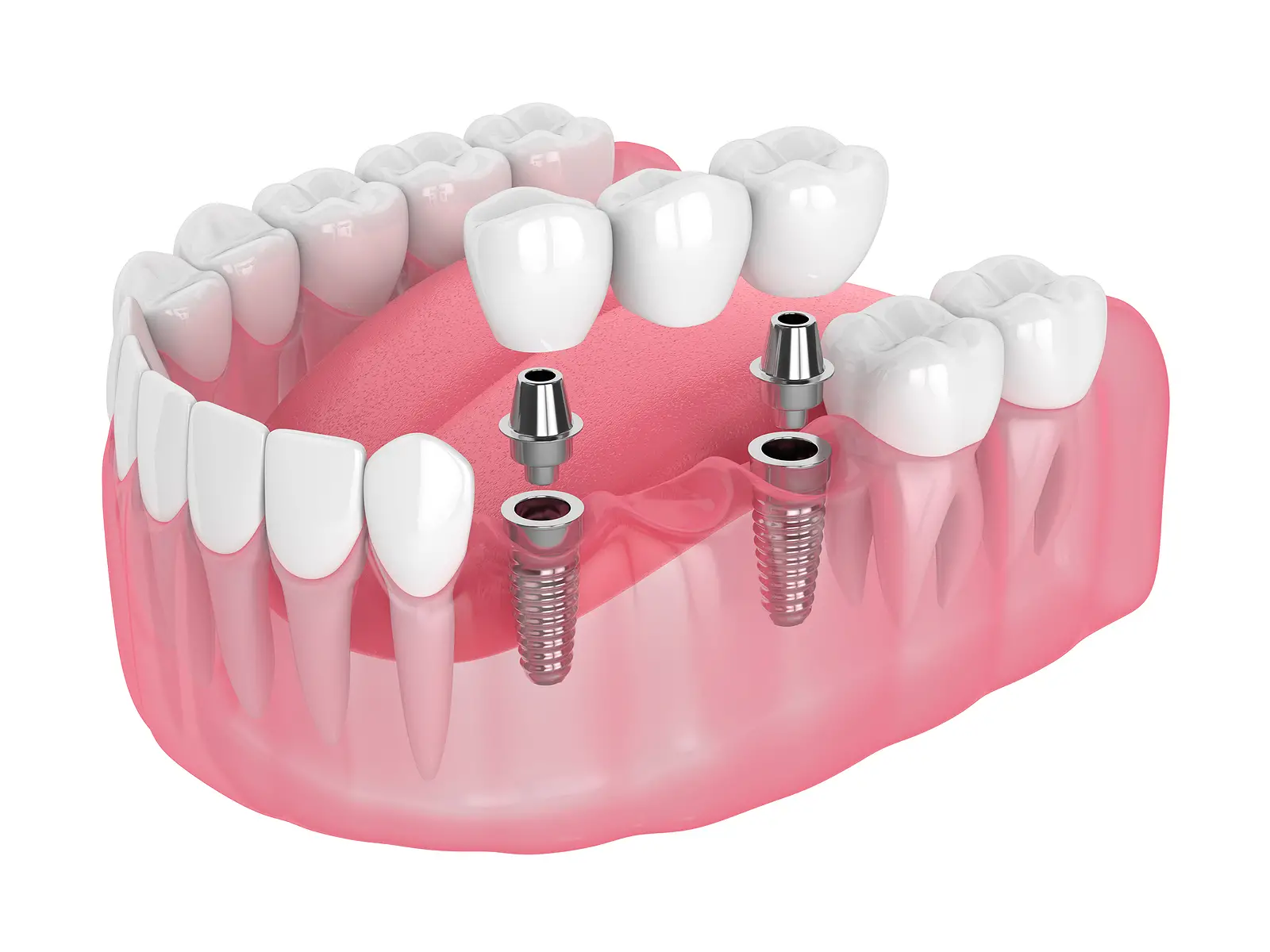 Dental Care of Sterling Dental Care of Sterling