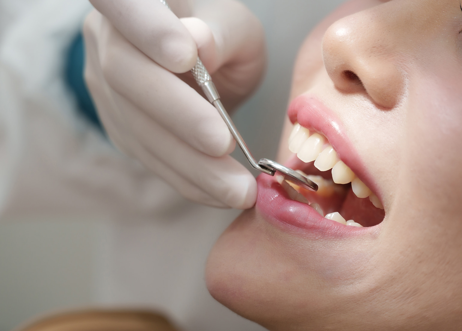 Overview of general dentistry services for maintaining healthy teeth and gums