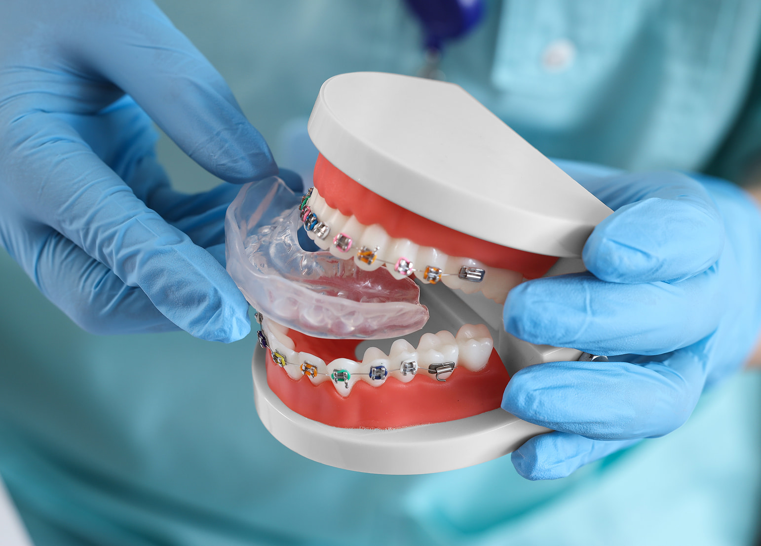 Signs you may need an occlusal guard, including jaw pain and tooth wear