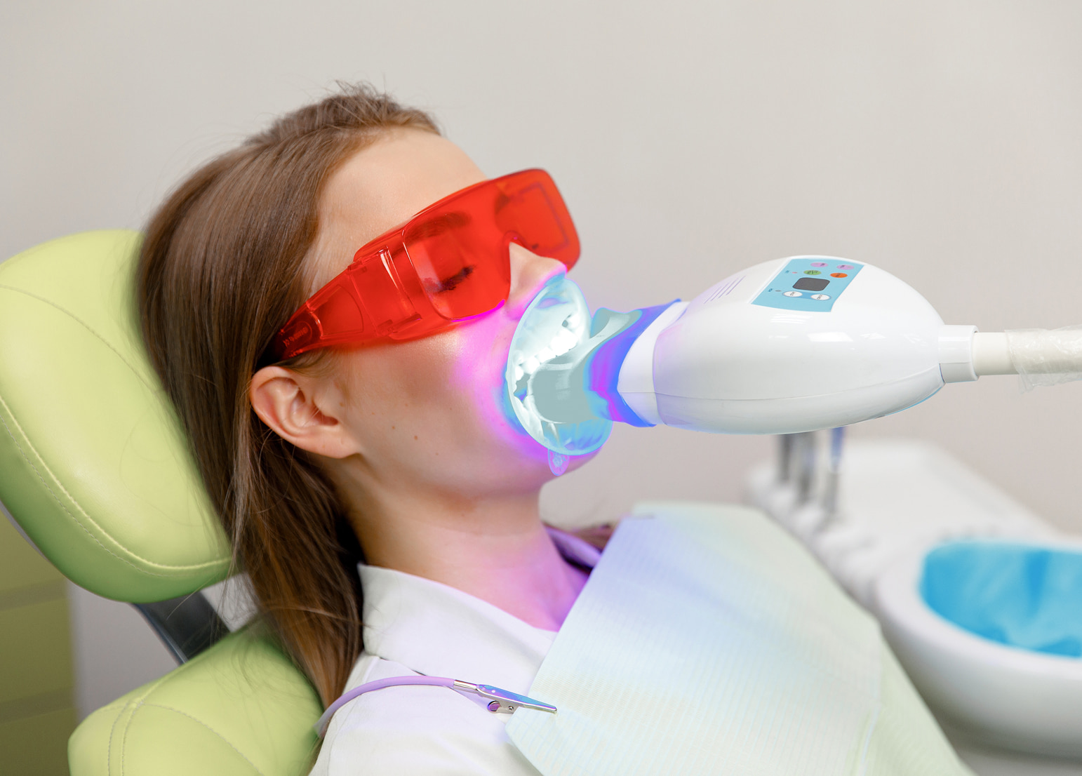 Common causes of tooth discoloration and staining